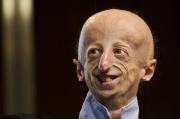 Img default alt hy