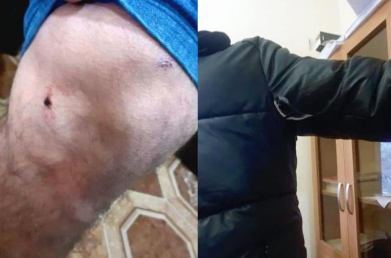 Img default alt hy