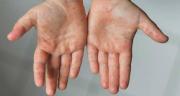 Img default alt hy