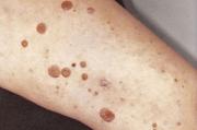 Img default alt hy